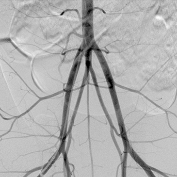 클릭하시면 영상이 재생됩니다